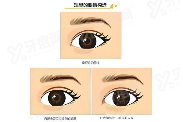 上海杜园园修复双眼皮多少钱？双眼皮修复4W - 5W/眼角修复3W - 5W/上下眼睑综合修复4W+ 