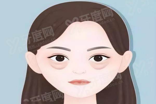 武汉钟爱梅医生割眼袋多少钱？协和专家亲诊5k~1w+安全靠谱附术式恢复指南
