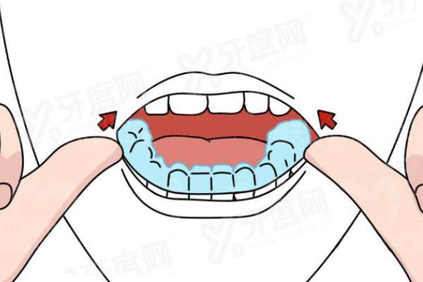 苏州正畸医生排名前十：李煌|周铭|詹慧|张军|王静等医生正畸技术好