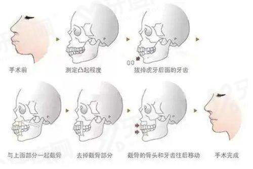 二、广州植发正规医院排名前三名yanke.yadoo.cn