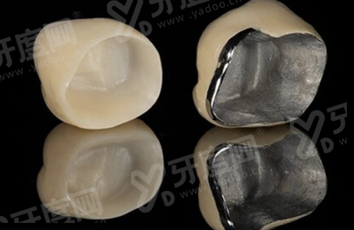 三、瑞士悦锆种植体价格?yanke.yadoo.cn