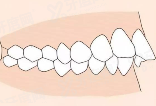 三、佛山好佰年口腔这家整牙好不好?好yanke.yadoo.cn