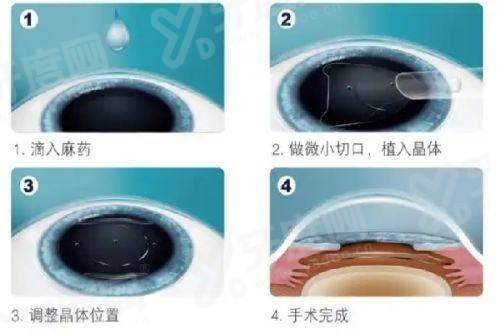 三、台州眼视光眼科医院价格表?(价格合理透明,多种项目可选)yanke.yadoo.cn