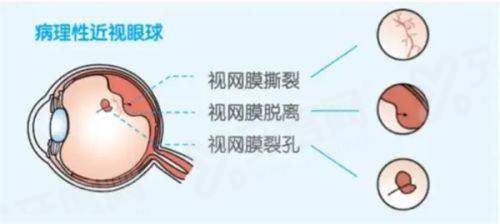 石家庄省二院眼科上班时间：早8:00-17:30！附地址路线+预约挂号攻略