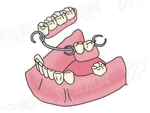 二、江门穗华口腔种牙价格表yanke.yadoo.cn