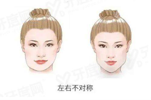 二、田永成做双眼皮的价格情况yanke.yadoo.cn