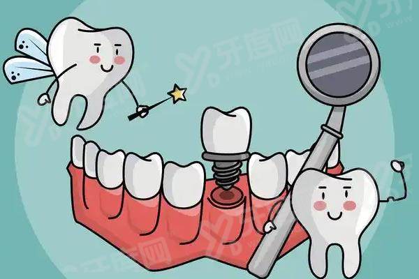 种牙一期疼还是二期疼？一期疼二期轻！种牙一期和二期中间一般隔3-6个月