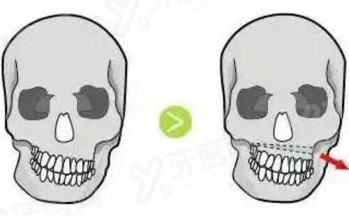 二、南京米兰柏羽医疗美容医院价格表yanke.yadoo.cn