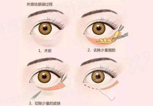 昆明吴氏嘉美整形收费价格表：双眼皮1980+/硅胶隆鼻4580+/光子嫩肤680+/热玛吉五代9800+