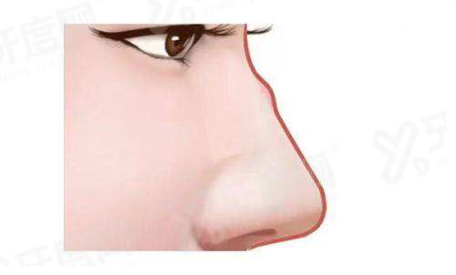 三、南京米兰柏羽医疗美容医院地址yanke.yadoo.cn