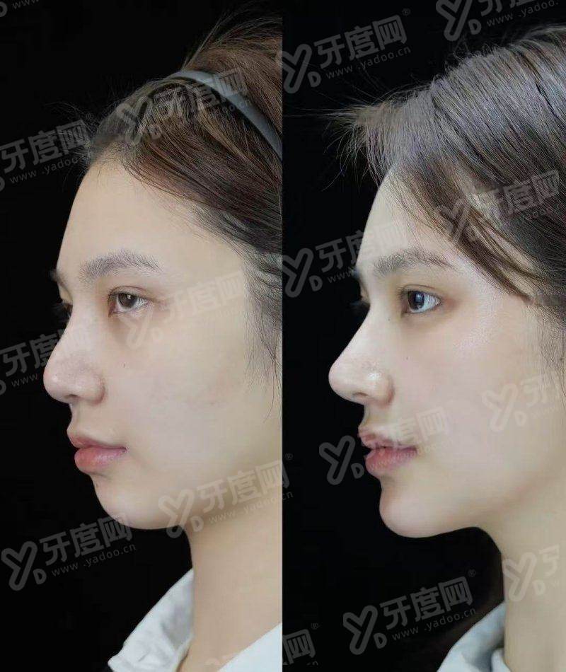 二、洛阳植发医院排名yanke.yadoo.cn