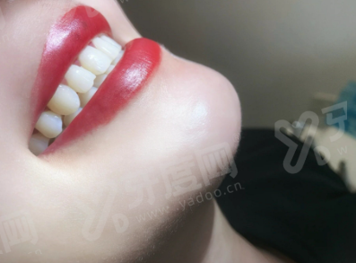 上海口腔科医院排名前十名：上海美奥/维乐/雅悦齿科技术好