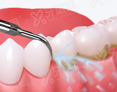 二、长沙新华口腔医院可以用医疗保险吗？yanke.yadoo.cn