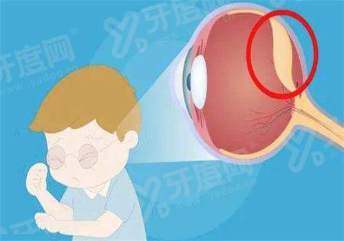 北京协和医院眼科2026价格表：挂号50-100元起+附东西单双院区地址