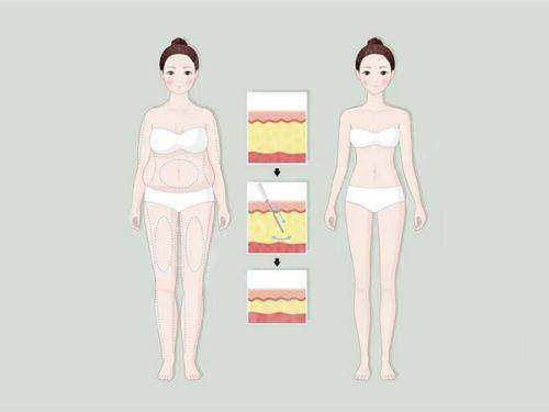 二、深圳富华谢福庚医生做眼睛多少钱？yanke.yadoo.cn