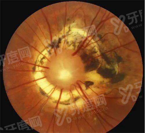 三、济宁医学校附属医院眼科怎么样？（综合实力强，诊疗成效好）yanke.yadoo.cn