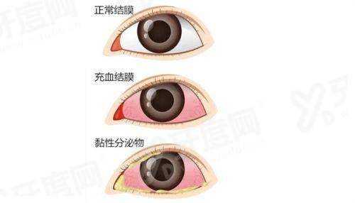 四、河北邢台眼科医院就诊攻略（预约挂号方式及流程）yanke.yadoo.cn