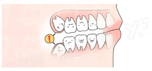 二、洗牙对牙齿有什么危害和好处yanke.yadoo.cn