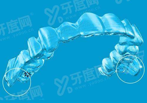 二、爱尔创全瓷牙能用几年？一般在10-15年左右yanke.yadoo.cn