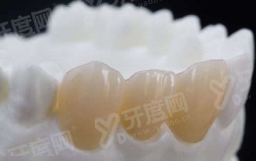 三、种植牙品牌排行榜前十名yanke.yadoo.cn