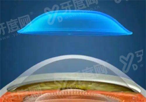 深圳市人民医院眼科上班时间：周一至周日8:00-17:30！地址路线+挂号方式揭晓