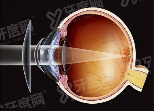 三、介绍咸阳泰舜眼科怎么样？（综合实力强，服务优质，患者口碑好）yanke.yadoo.cn