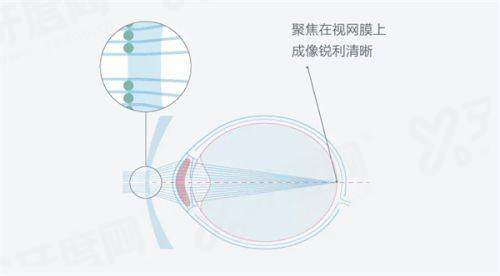咸阳泰舜眼科地址在哪？在秦都区渭阳西路，16路公交车直达！