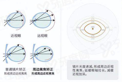 三、盐城市中医院眼科怎么样？（患者评价+诊疗优势）yanke.yadoo.cn