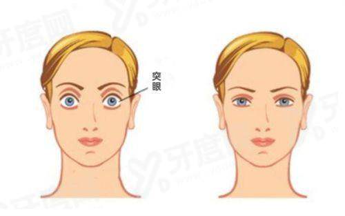 兰州普瑞眼科怎么预约挂号？3种方式+价格表+地址路线公布