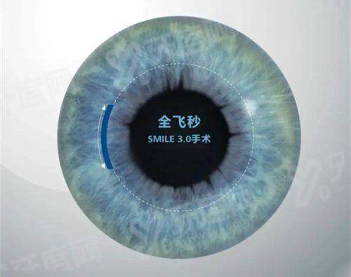 北京清华长庚医院眼科患者反馈好吗？好评如潮！了解挂号详情及电话