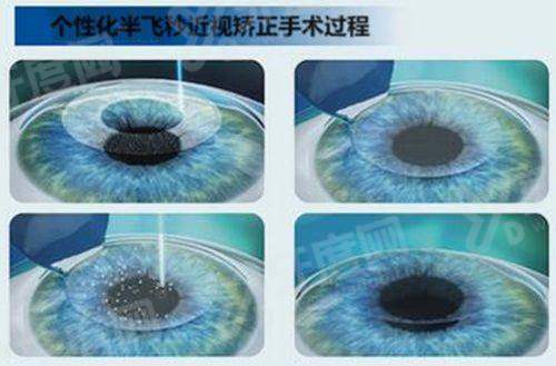 延吉爱尔眼科坐几路公交车到？1路/3路/16路直达！预约超省心+价格全透明