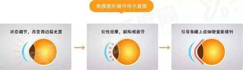 南京鼓楼医院眼科手术价目表 半飞秒10k+/全飞秒15k+/其他个性化手术20k+ 