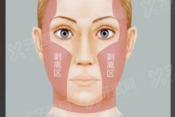 刘文阁取生长因子怎么样？分层定位+微创隐痕+专属修复技术，不少人反馈恢复效果挺好的！