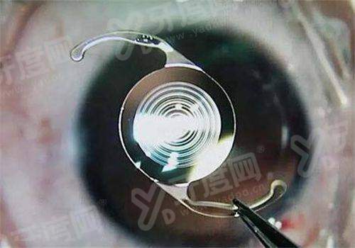 四、兰大二院眼科预约挂号攻略yanke.yadoo.cn