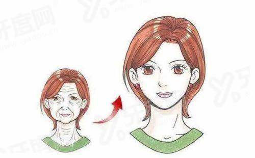 卢丙仑医生做拉皮手术价格：小拉皮8千+大拉皮1.8万起，卢丙仑做拉皮手术好