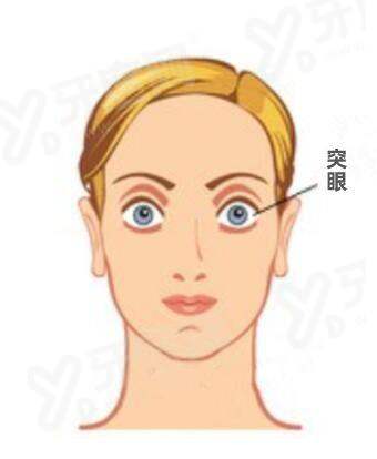 四、兰大二院眼科预约挂号方式及流程yanke.yadoo.cn