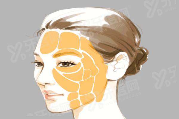 北京艺星自体脂肪面部填充怎么样？高纯度提纯技术让脂肪存活率更高，价格透明无隐形消费