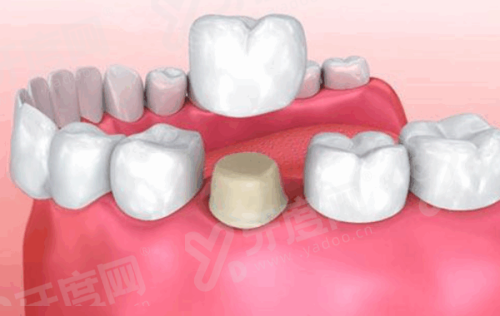 四、预约与就诊相关说明yanke.yadoo.cn