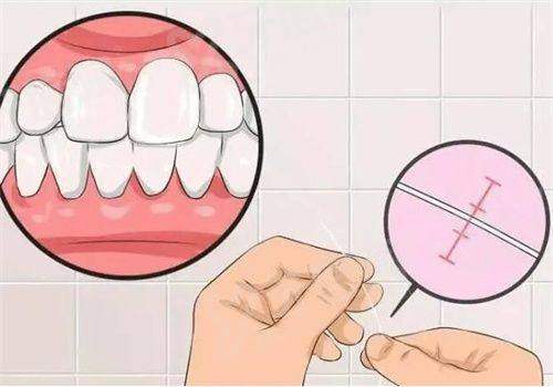 三、潍坊中牙口腔医院价格表？（2024年收费透明，性价比高）yanke.yadoo.cn