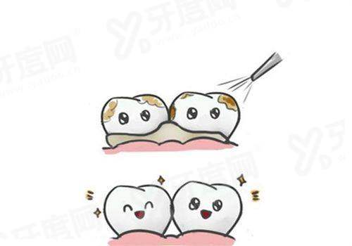 二、马里兰桥义齿价格表?(2023年参考价格:单颗3000元起,具体因材料和基牙情况而异)yanke.yadoo.cn