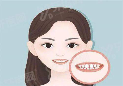 三、解答：iti种植体三种型号的区别yanke.yadoo.cn