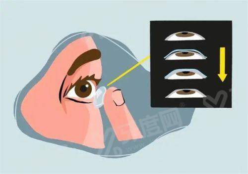 三、湛江爱尔眼科医院预约挂号？yanke.yadoo.cn