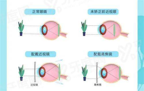 二、介绍长沙市第一医院眼科怎么样？（正规可靠，医生技术强，服务优质）yanke.yadoo.cn