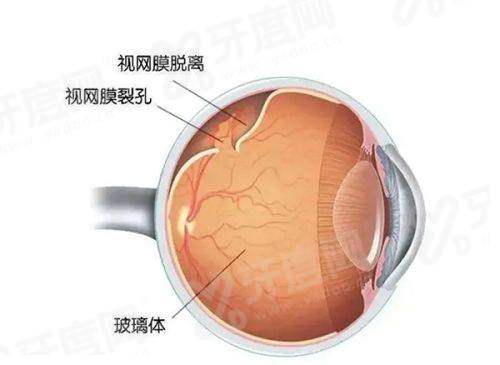 二、铜梁人民医院眼科怎么样？（设备精良医生专精，诊疗服务口碑较好）yanke.yadoo.cn