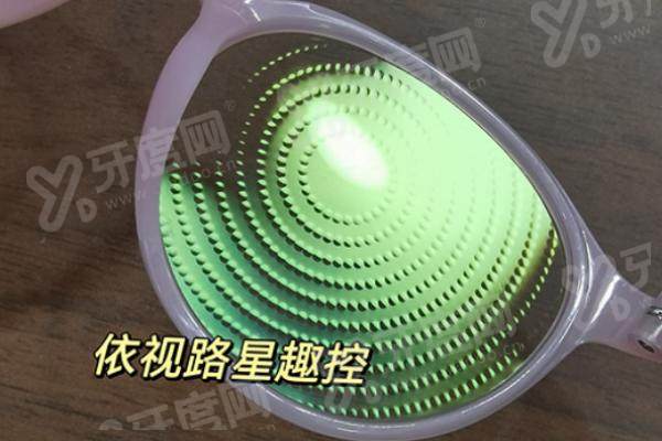 星趣控镜片在哪里配好啊？选官方授权机构验光精准建档追踪，价格透明放心