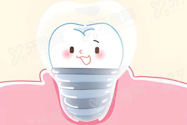 mvpbio种植体是哪国的？源自瑞士！解析mvpbio与pcc植体哪个好！ 