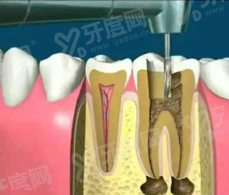 四、极简一站式口腔医院总院坐诊地址及预约挂号方式yanke.yadoo.cn
