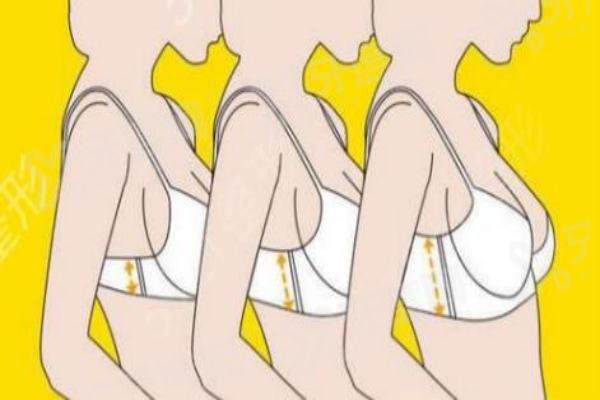 郑州徐林刚做缩胸手术怎么样啊？技术靠谱效果自然，价格区间适中，资深专家方案个性化恢复快