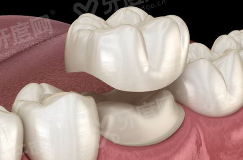 二、2026上海赫尔森口腔医院价格表医院怎么样?yanke.yadoo.cn