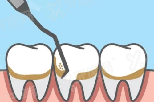 天津牙诚口腔医院如何预约挂号？3种预约方式+价格表+地址路线公布